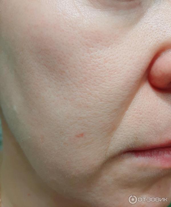 Антиоксидантная сыворотка для лица La Roche-Posay Vitamin C10 фото