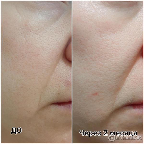 Антиоксидантная сыворотка для лица La Roche-Posay Vitamin C10 фото