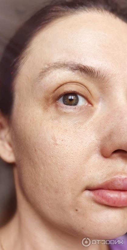 Сыворотка La Roche Posay Pure Vitamin C10 фото