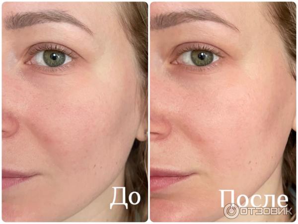 Сыворотка TOLERIANE ULTRA DERMALLERGO La Roche-Posay