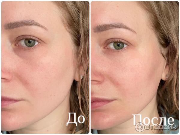 Сыворотка TOLERIANE ULTRA DERMALLERGO La Roche-Posay