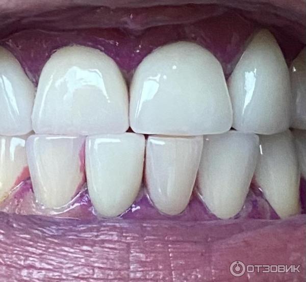 Отзыв о Таблетки для индикации зубного налета Denneo | Легко приучите ...