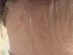 Очищающий гель для умывания La Roche-Posay Effaclar для жирной и чувствительной кожи фото